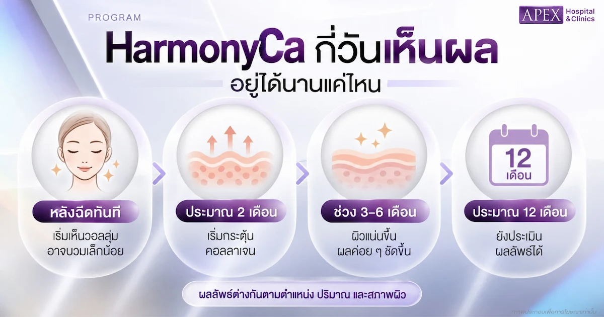 ฉีด HArmonyCa กี่วันเห็นผล และอยู่ได้นานแค่ไหน