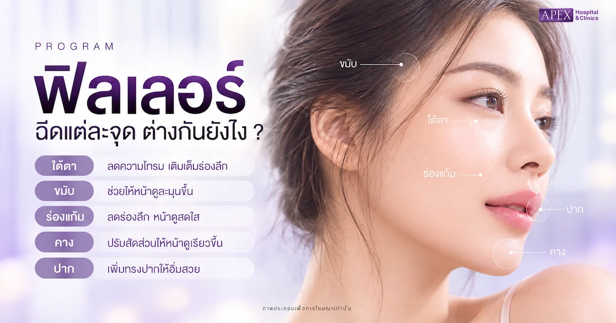 ฉีดฟิลเลอร์ตรงไหนเห็นความต่าง