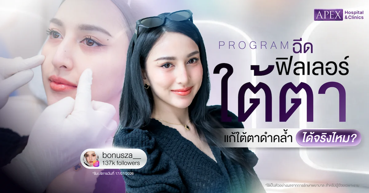 ฉีดฟิลเลอร์ใต้ตา ยี่ห้อไหนดี ราคาเท่าไหร่ อยู่ได้นานไหม