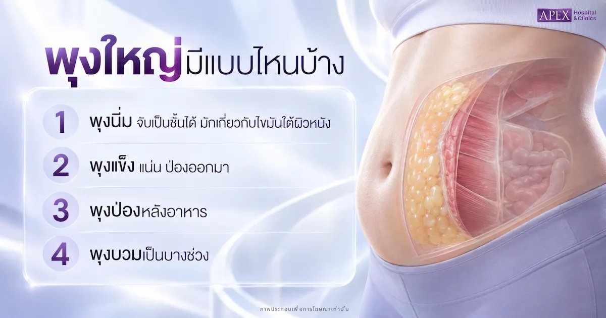 พุงใหญ่เกิดจากอะไร