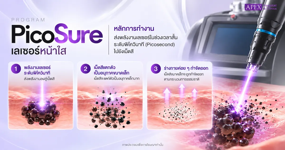 หลักการทำงานของเครื่อง PicoSure