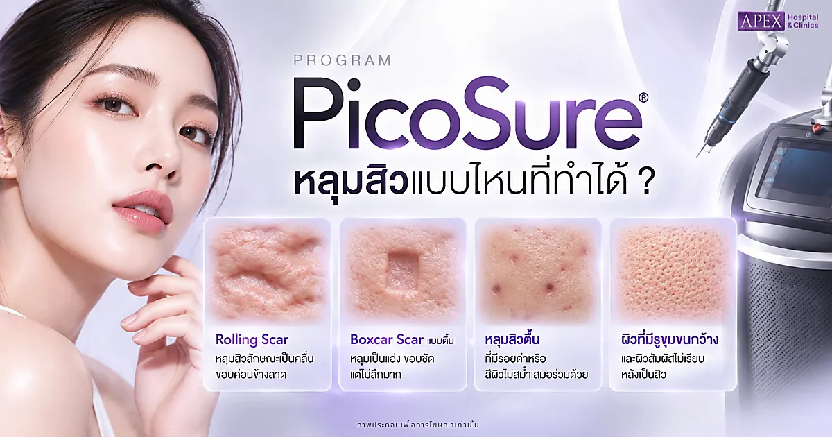 หลุมสิวแบบไหนที่ทำ PicoSure ได้