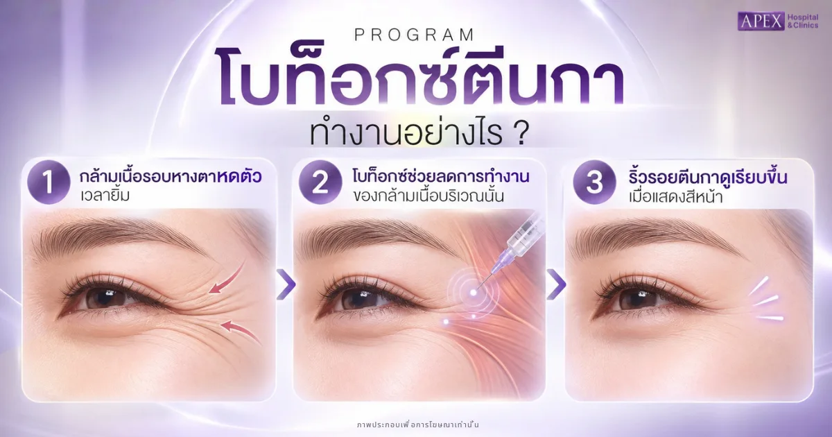 โบท็อกตีนกาทำงานอย่างไร