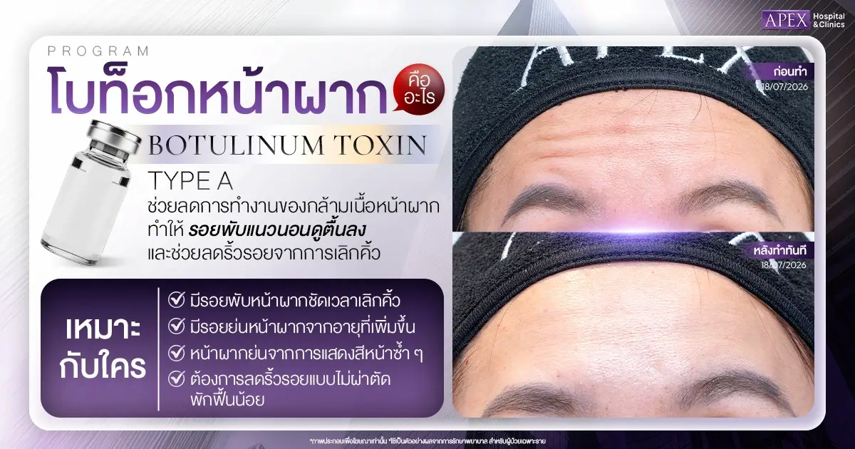 โบท็อกหน้าผาก คืออะไร เหมาะกับใคร