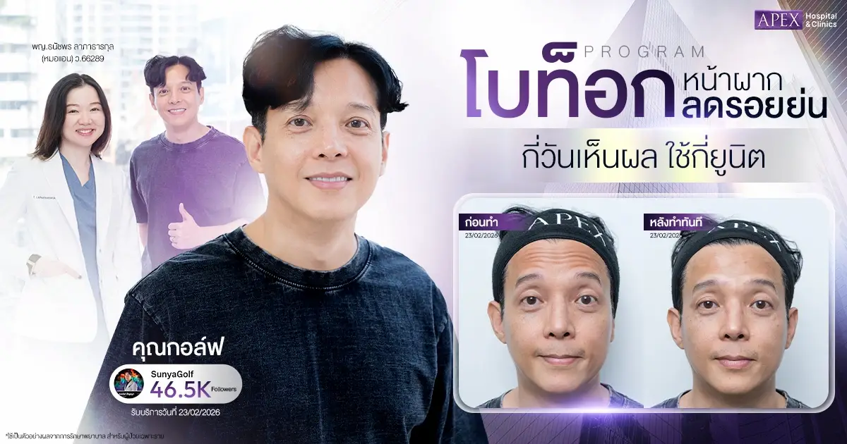 โบท็อกหน้าผาก