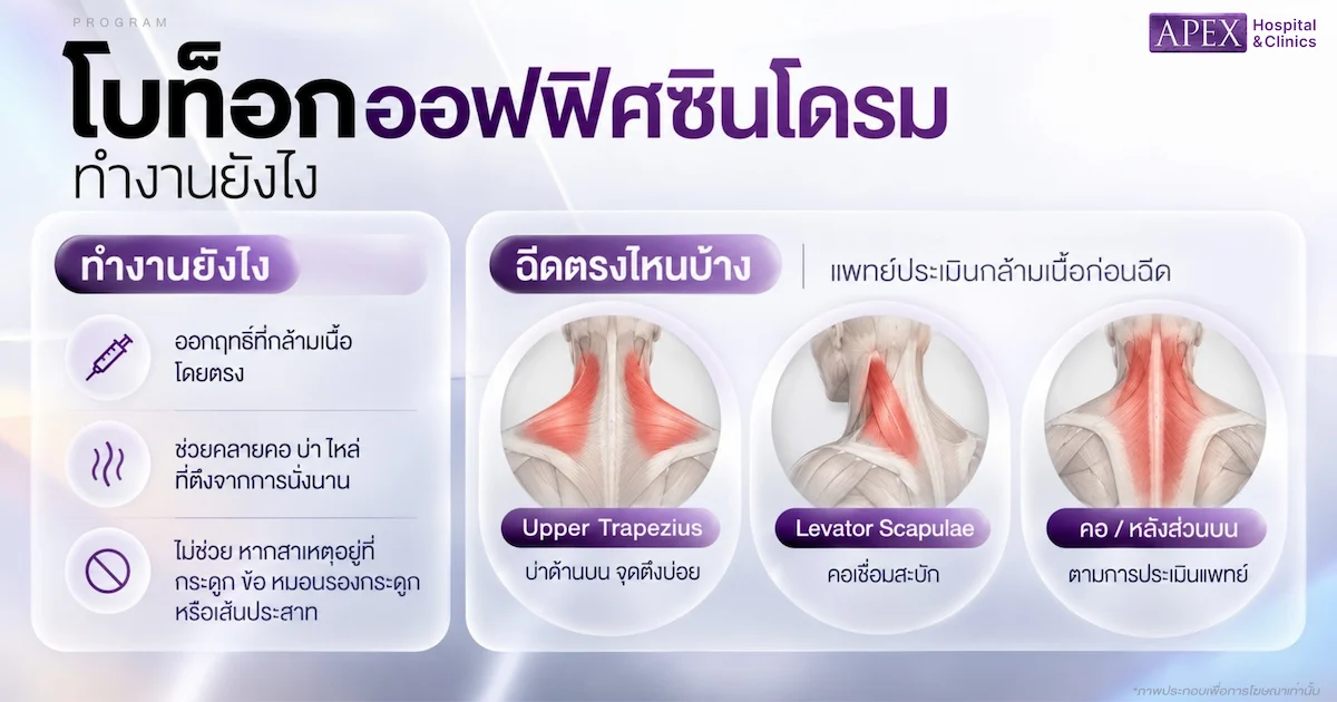 โบท็อกออฟฟิศซินโดรม ทำงานยังไง ฉีดตรงไหนบ้าง