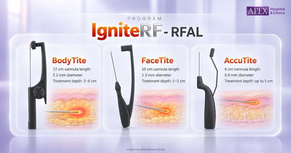 IgniteRF กลุ่ม RFAL 3 หัว