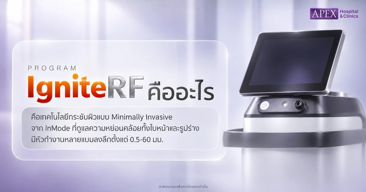 IgniteRF คืออะไร