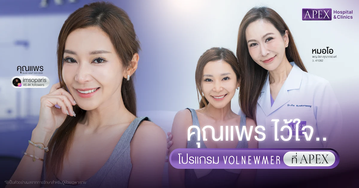 ทำ Volnewmer ที่ APEX