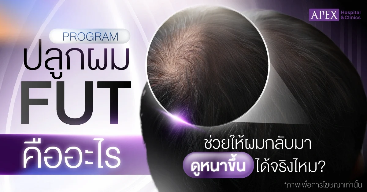 ปลูกผม FUT คืออะไร เทคนิคนี้ช่วยให้ผมกลับมาดูหนาขึ้นได้ถาวรไหม