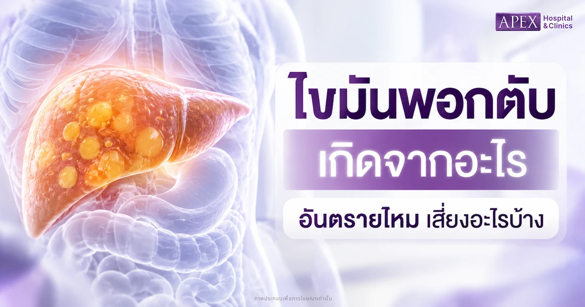 ไขมันพอกตับ เกิดจากอะไร อันตรายไหม เสี่ยงอะไรบ้าง